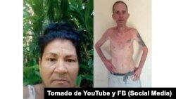 Moraima Rodríguez Batista denunció que le robaron los alimentos de su hijo el prisionero político enfermo de cáncer Alexander Díaz Rodríguez.