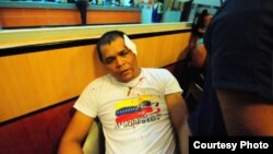 Siete jóvenes resultaron heridos y fueron trasladados de urgencia a un centro hospitalario (Foto: cortesía de Globovisión).