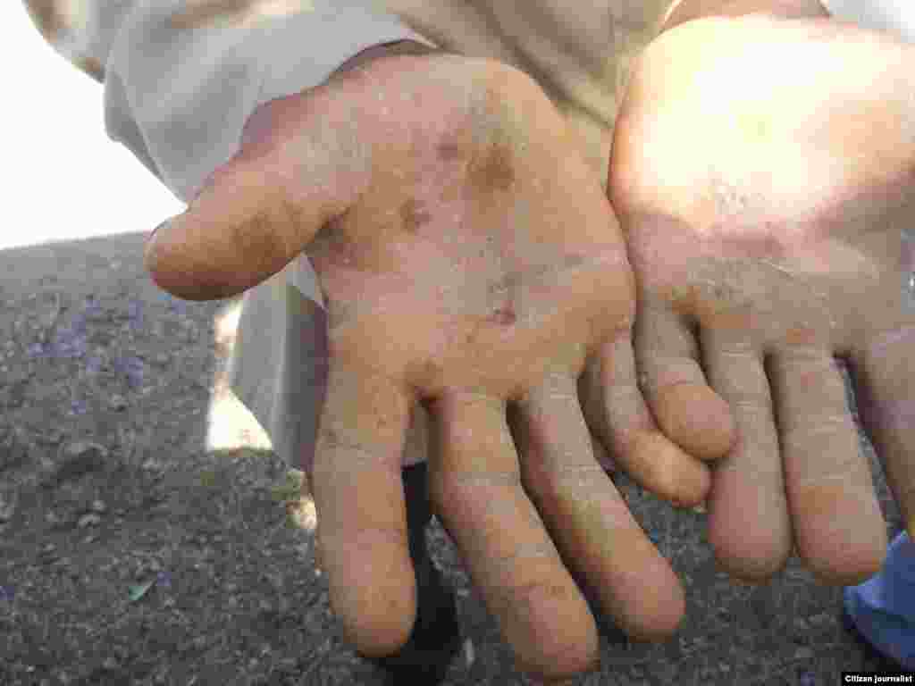 Condiciones en que trabajan los recolectores de ensinas en Pinar del Río.&nbsp;