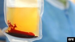 Fotografía de archivo. Una bolsa con células madre extraído de un tanque de conservación criogénica, con nitrógeno líquido.