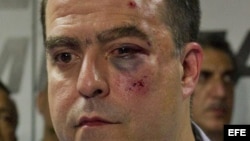 El diputado opositor Julio Borges.