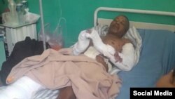 Juan Alberto De la Nuez Ramírez fue brutalmente golpeado por una banda de delincuentes, denunció el Consejo para la Transición Democrática en Cuba. (Facebook/José Daniel Ferrer)