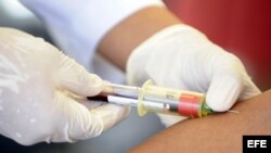 La prevalencia del VIH/SIDA en Cuba se concentra en la franja de 20 a 29 años de edad.